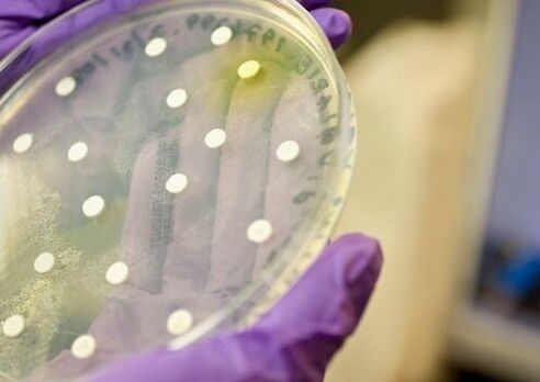 bakteriell Kultur fir d'Diagnostik vun Prostatitis